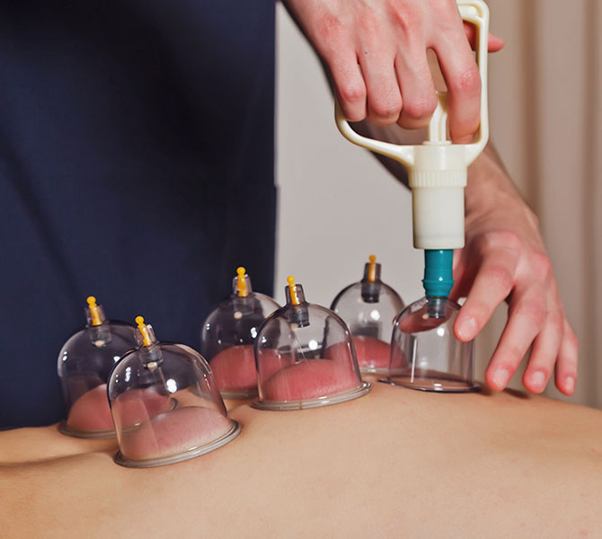 Hijama & Cupping Therapy carenurse healthcare in Gurgaon