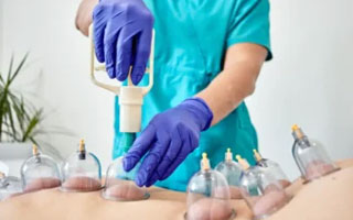 Cupping Therapy carenurse healthcare gurgaon delhi ncr india