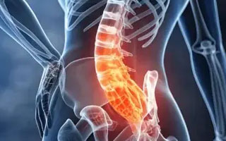 Sciatica carenurse healthcare gurgaon delhi ncr india